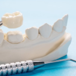 How Long Do Dental Crowns Last Tips For Proper Care