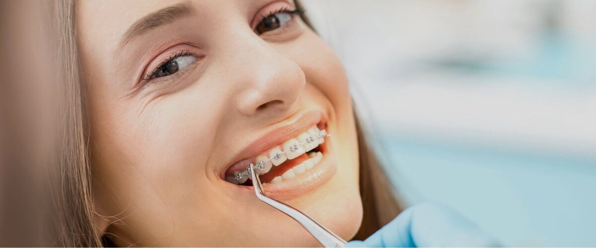 Care-Following-Orthodontics-–-Retainers