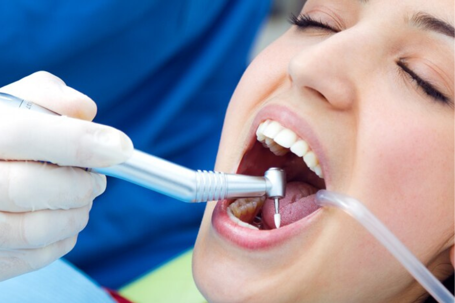 Tooth Extraction