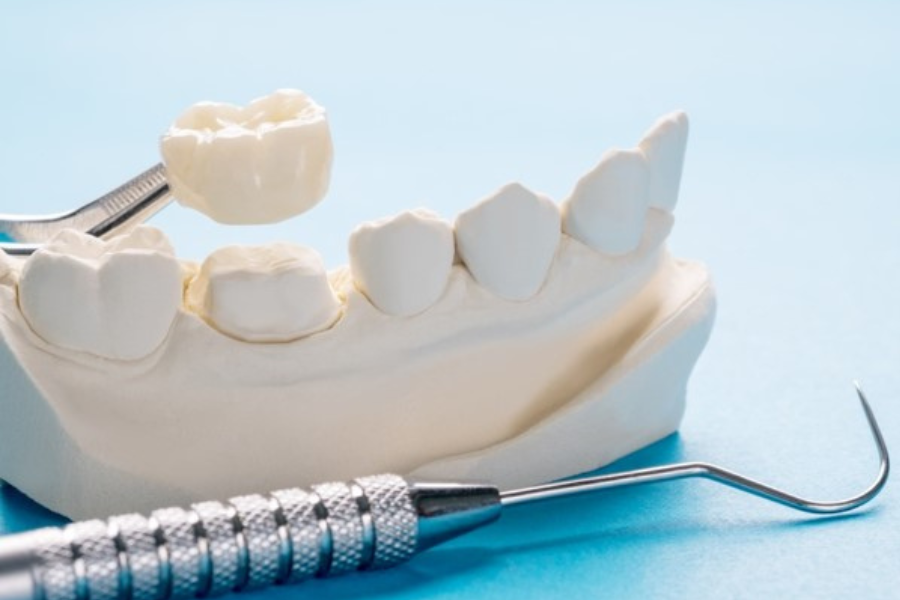 dental crowns