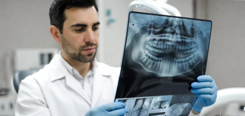 Dental Xray